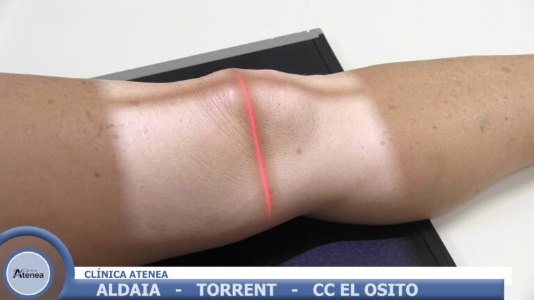 Centros de Fisioterapia en Aldaia: Opciones y Servicios